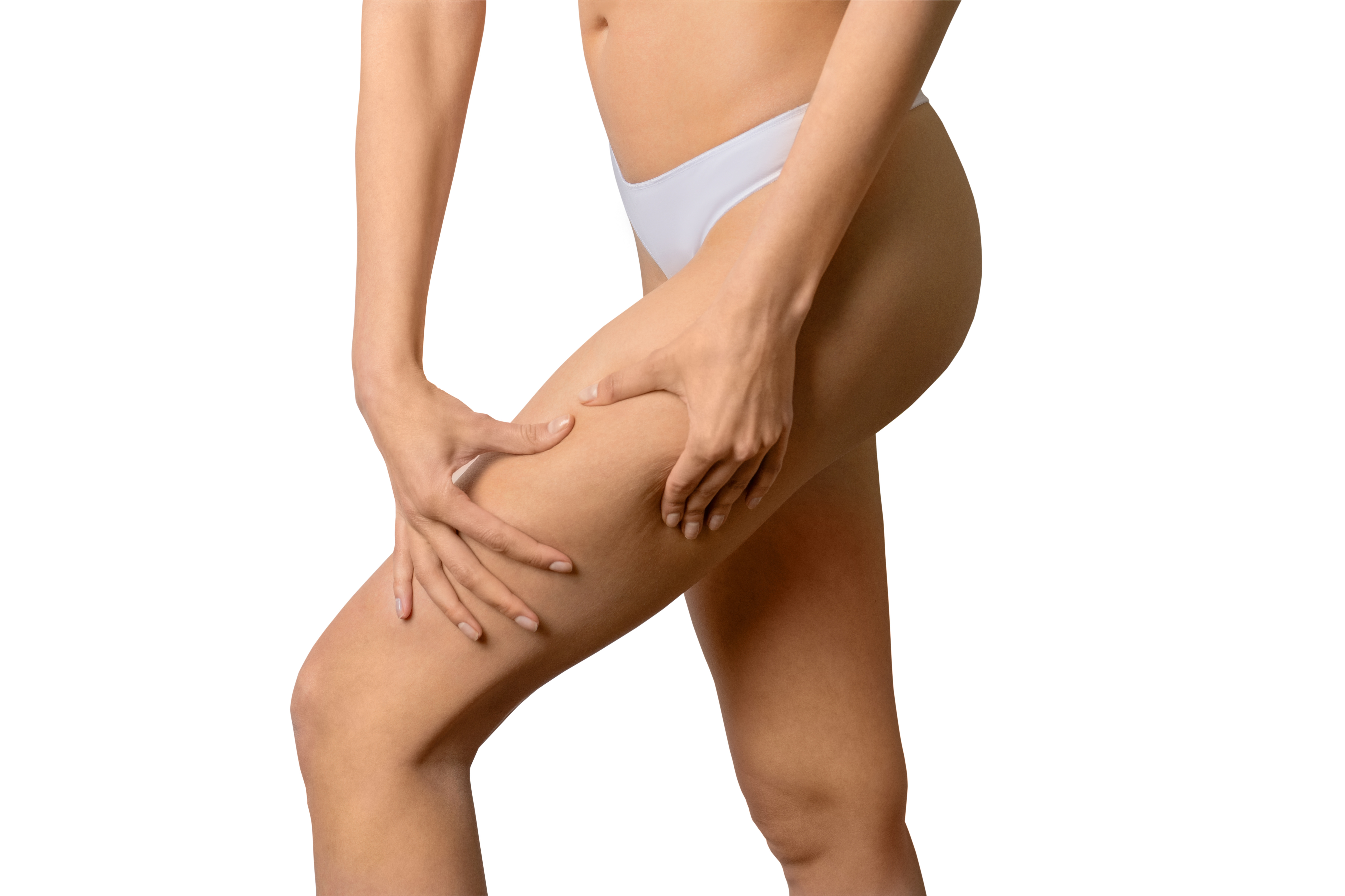 Tratament celulită Timișoara